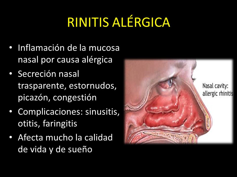 Las consecuencias de la psoriasis pustular